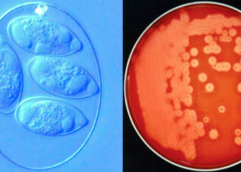 coccidiosis symptoms chickens
