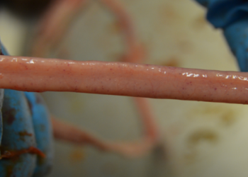 Lesion Score 1 by Eimeria maxima.